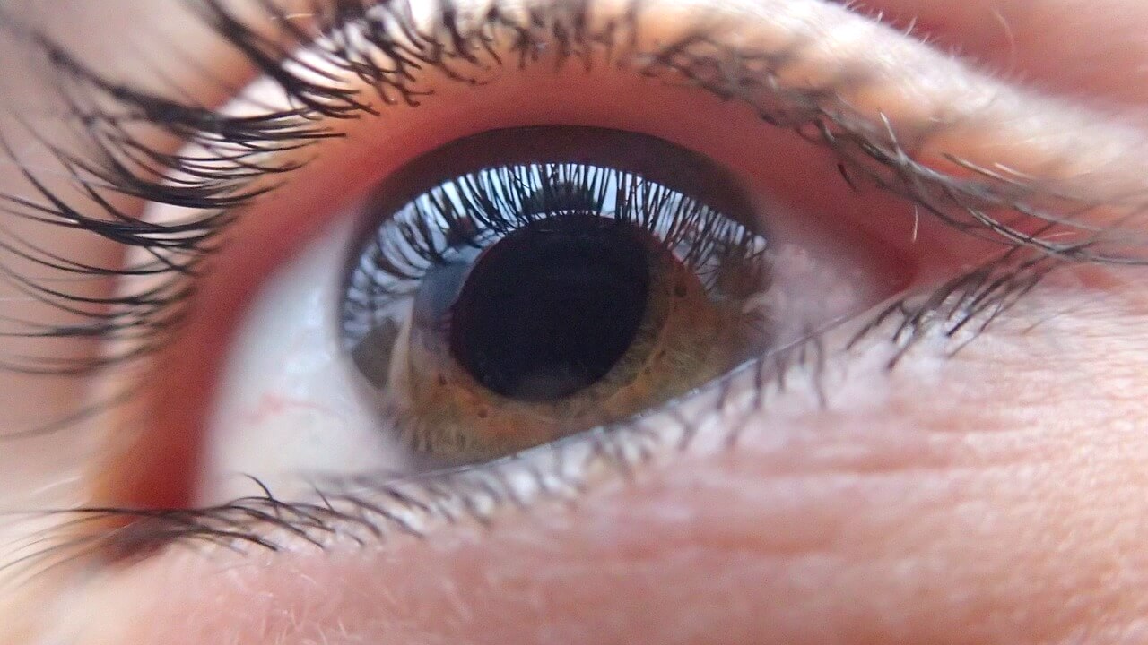 Afectiuni oculare frecvente - oftalmologie, imagine generica